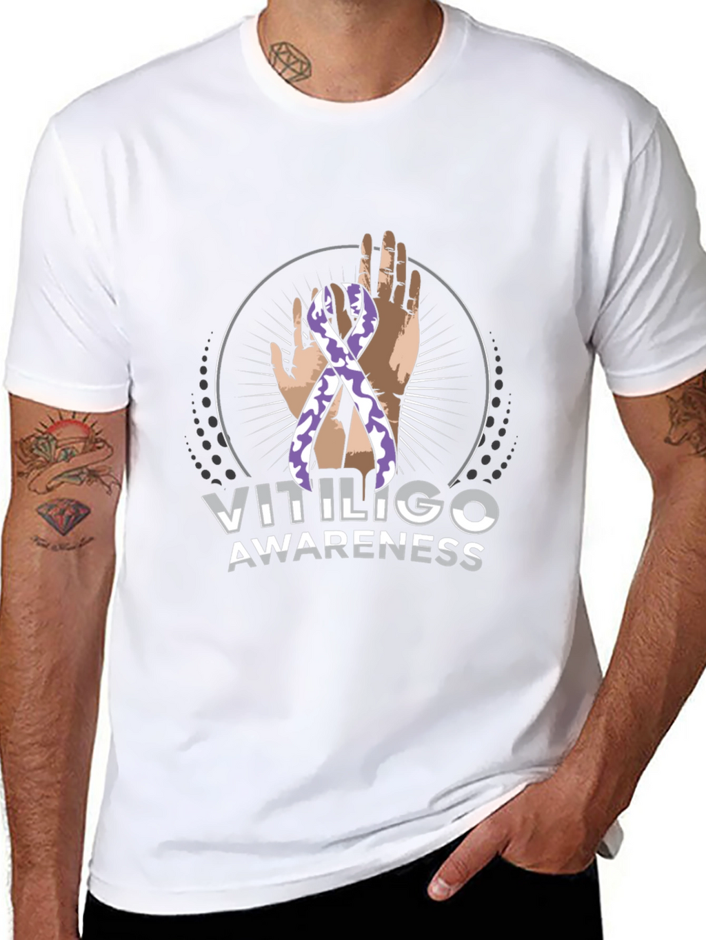 Vitiligo Awareness T-Shirt - Black